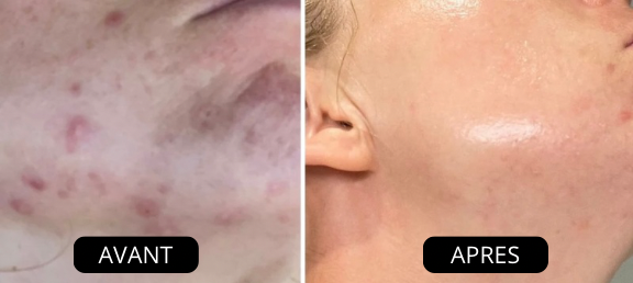 NüVia™ pommeau de douche haute pression